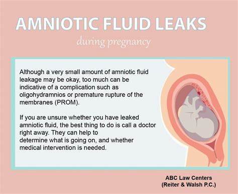 Leaking Amniotic Fluid: Signs, Causes, and Symptoms